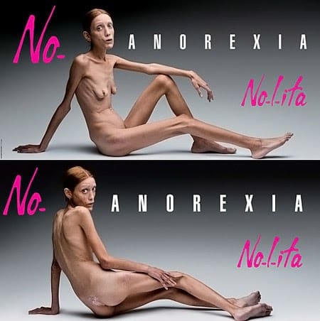 No anorexia